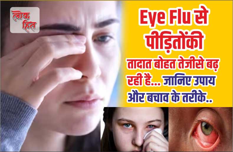 Eye Flu