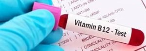 Increase Vitamin B12-test